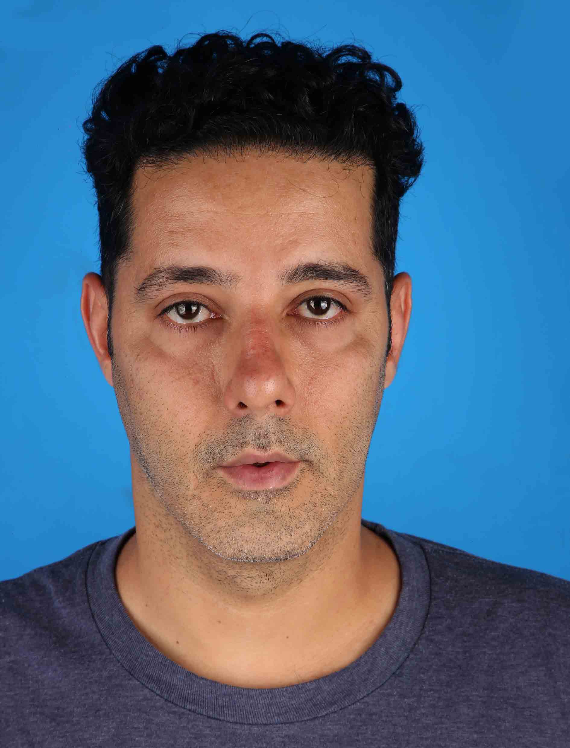 هزینه فتوگرافی بینی _ آتلیه تخصصی عکاسی پزشکی|روزگارخوش